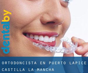 Ortodoncista en Puerto Lápice (Castilla-La Mancha)