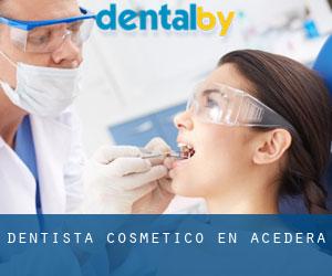 Dentista Cosmético en Acedera