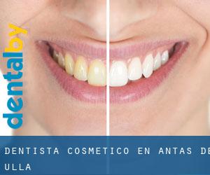 Dentista Cosmético en Antas de Ulla