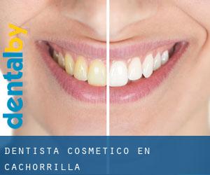 Dentista Cosmético en Cachorrilla