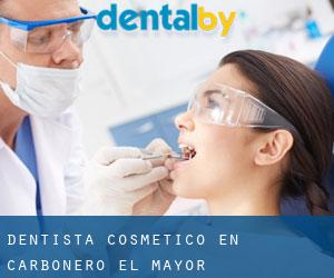 Dentista Cosmético en Carbonero el Mayor