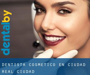 Dentista Cosmético en Ciudad Real (Ciudad) Dentista Cosmético en Ciudad Real (Ciudad)