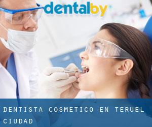 Dentista Cosmético en Teruel (Ciudad) Dentista Cosmético en Teruel (Ciudad)