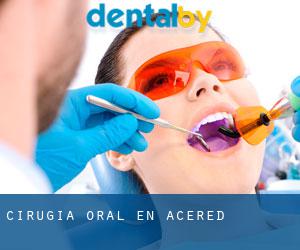 Cirugía Oral en Acered