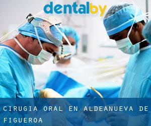 Cirugía Oral en Aldeanueva de Figueroa