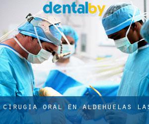 Cirugía Oral en Aldehuelas (Las)