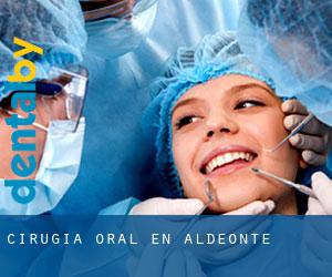 Cirugía Oral en Aldeonte