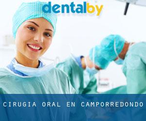 Cirugía Oral en Camporredondo