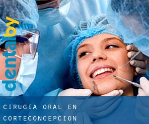 Cirugía Oral en Corteconcepción