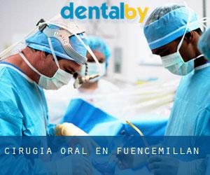 Cirugía Oral en Fuencemillán