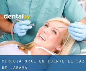 Cirugía Oral en Fuente el Saz de Jarama
