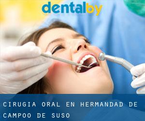 Cirugía Oral en Hermandad de Campoo de Suso