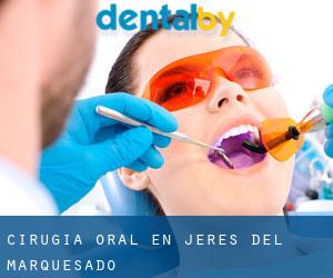 Cirugía Oral en Jeres del Marquesado