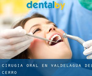 Cirugía Oral en Valdelagua del Cerro
