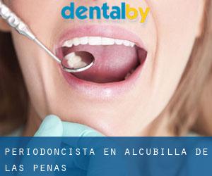 Periodoncista en Alcubilla de las Peñas