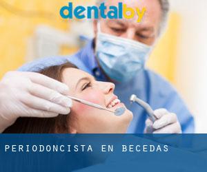 Periodoncista en Becedas