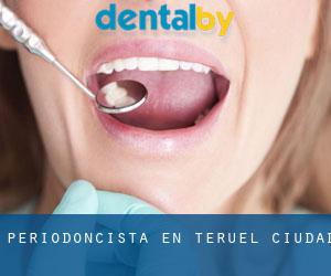 Periodoncista en Teruel (Ciudad) Periodoncista en Teruel (Ciudad)
