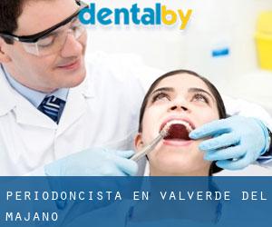 Periodoncista en Valverde del Majano