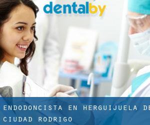 Endodoncista en Herguijuela de Ciudad Rodrigo