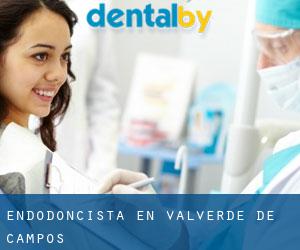 Endodoncista en Valverde de Campos