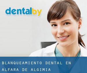 Blanqueamiento dental en Alfara de Algimia