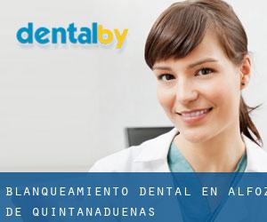 Blanqueamiento dental en Alfoz de Quintanadueñas