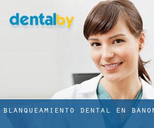 Blanqueamiento dental en Bañón