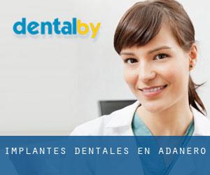 Implantes Dentales en Adanero