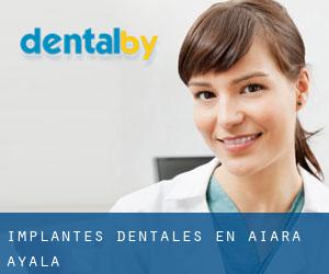 Implantes Dentales en Aiara / Ayala