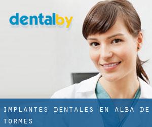Implantes Dentales en Alba de Tormes