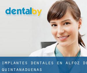 Implantes Dentales en Alfoz de Quintanadueñas