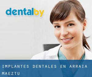 Implantes Dentales en Arraia-Maeztu