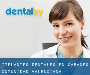 Implantes Dentales en Cabanes (Comunidad Valenciana)