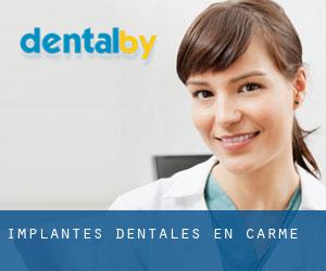 Implantes Dentales en Carme
