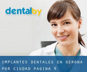 Implantes Dentales en Gerona por ciudad - página 4