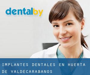 Implantes Dentales en Huerta de Valdecarábanos