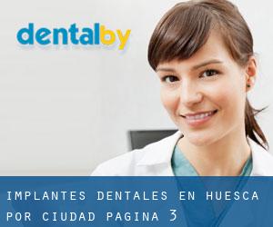 Implantes Dentales en Huesca por ciudad - página 3