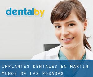 Implantes Dentales en Martín Muñoz de las Posadas