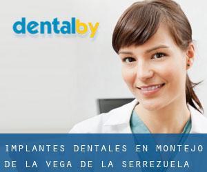 Implantes Dentales en Montejo de la Vega de la Serrezuela