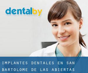 Implantes Dentales en San Bartolomé de las Abiertas