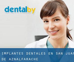 Implantes Dentales en San Juan de Aznalfarache