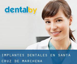 Implantes Dentales en Santa Cruz de Marchena