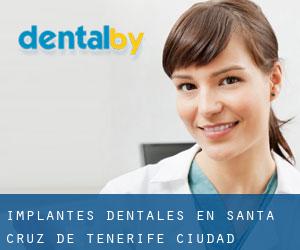 Implantes Dentales en Santa Cruz de Tenerife (Ciudad)