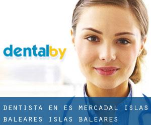 dentista en Es Mercadal (Islas Baleares, Islas Baleares)